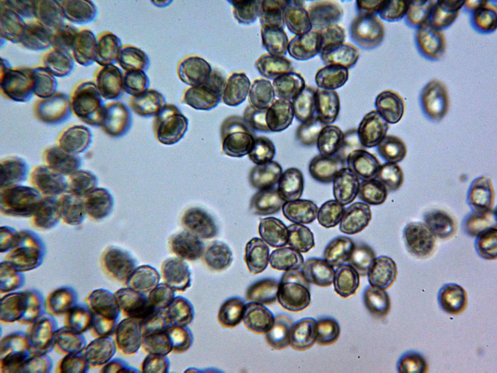 Microscopía de Melanoleuca rasilis - 10 - Esporada Melzer 2